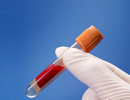 高血脂，隱秘的溫柔殺手